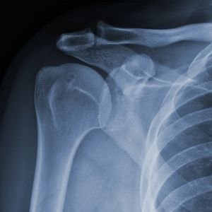 Musculoskeletal Elastography