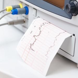 Fetal Heartbeat Monitoring