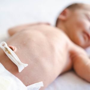 Umbilical Cord Blood Flow Assessment