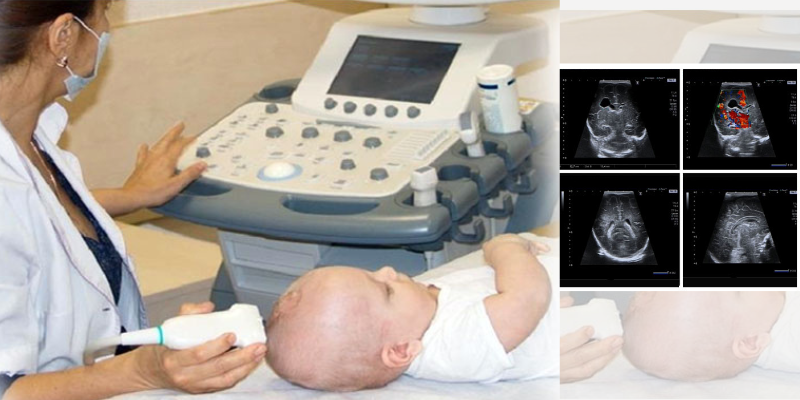 Elastography & Neurosonography