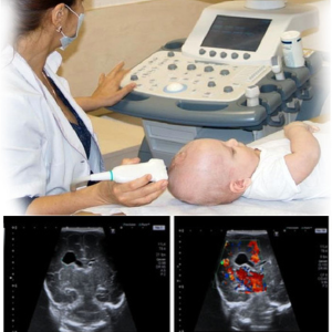 Elastography and Neurosonography in Saharsa