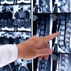 Brain & Spinal Cord MRI