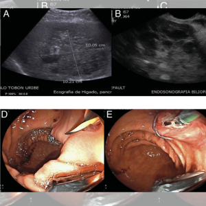 Ultrasound Guided Procedures in Saharsa