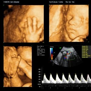 3D, 4D & 5D Ultrasound Imaging