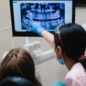 Dental X-Ray